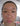 Asian girl with skin peeling off face
