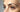 Reducing Deep Forehead Wrinkles at Home: A Professional Guide to Skin Resurfacing