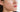 At Home Chemical Peel for Cystic Acne: The Guide to Deep Resurfacing - Skin Culture