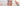 At-Home Chemical Peel vs Microneedling: The 2026 Guide to Clinical Results - Skin Culture
