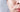 At-Home Peel for Acne Scars: 6-Day Skin Resurfacing Guide - Skin Culture