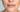 At-Home Peel for Sun Damage: The Professional 6-Day Resurfacing Guide - Skin Culture