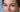 Best Home Treatment for Crow’s Feet: Achieving Clinical Results Without Botox - Skin Culture