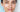 Chemical Peel and Facial: Which Treatment Is Right for Your Skin? - Skin Culture