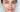 Chemical Peel and Facial: Which Treatment Is Right for Your Skin? - Skin Culture