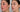 Chemical Peel at Home Gone Wrong: How to Recover and Avoid Disasters - Skin Culture