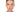 Chemical Peel Before and After: The Complete Guide to Visible Skin Transformation - Skin Culture