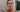 Chemical Peel Healing Process Day by Day: The 6-Day Transformation Guide - Skin Culture