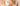 Chemical Peel Peeling: Understanding the Resurfacing and Shedding Process - Skin Culture