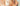 Chemical Peel Peeling: Understanding the Resurfacing and Shedding Process - Skin Culture
