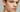 Choosing the Best Treatment for Spots, Blemishes, Blackheads, and Oily Skin - Skin Culture