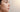 Getting Rid of Acne Scars Before Your Wedding: The Professional At-Home Guide - Skin Culture
