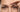 How to Get Rid of Forehead Wrinkles: Professional Guide - Skin Culture