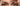 How to Get Rid of Forehead Wrinkles: Professional Guide - Skin Culture