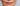 How to Get Rid of Smokers Lines Around the Mouth: A 2026 Guide to At-Home Resurfacing - Skin Culture