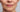 How to Get Rid of Smokers Lines Around the Mouth: A 2026 Guide to At-Home Resurfacing - Skin Culture
