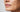 How to Get Rid of Stubborn Brown Spots on Face: A Professional 2026 Guide - Skin Culture
