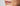 How to Get Rid of Stubborn Brown Spots on Face: A Professional 2026 Guide - Skin Culture