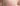Light Chemical Peel: The Professional Guide to Superficial Skin Resurfacing - Skin Culture