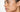 Melasma Home Treatment: A Professional Guide to Effective Skin Resurfacing - Skin Culture