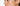 Melasma Home Treatment: A Professional Guide to Effective Skin Resurfacing - Skin Culture