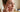 My Face is Raw After a Chemical Peel: Is This Normal and How Do I Treat It? - Skin Culture