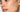 Post Inflammatory Hyperpigmentation Treatment at Home: The 2026 Resurfacing Guide - Skin Culture