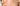 Post Inflammatory Hyperpigmentation Treatment at Home: The 2026 Resurfacing Guide - Skin Culture