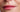 Professional Home Treatment for Lower Face Wrinkles: A 2026 Guide - Skin Culture
