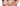 Reversing Sun Damage on Face at Home: The 2026 Resurfacing Guide - Skin Culture