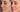 Safest At-Home Chemical Peel: Professional Results - Skin Culture
