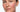 Signs of Infection After Chemical Peel: A Safety Checklist for At-Home Recovery - Skin Culture