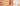 Skin Culture Peel Results: What to Expect from the 6-Day Transformation - Skin Culture