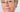 Will a Chemical Peel Remove Age Spots? A Professional Guide to Home Resurfacing - Skin Culture