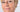 Will a Chemical Peel Remove Age Spots? A Professional Guide to Home Resurfacing - Skin Culture