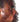 man with skin peeling off face