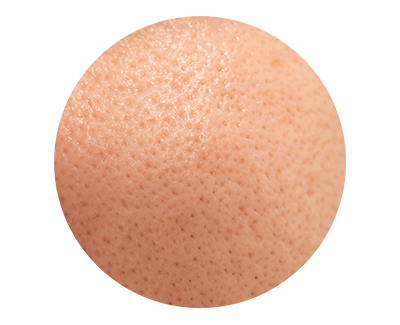 Large Pores
