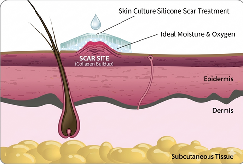 Silicone Scar Treatment product