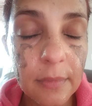 Peeling process — revealing fresh, new, baby soft skin